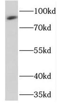 PRKG2 Rabbit Polyclonal Antibody