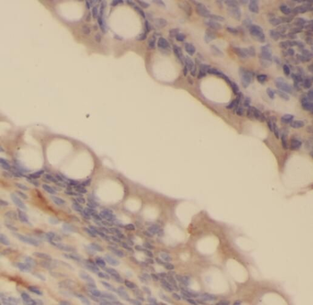 PRKG2 Rabbit Polyclonal Antibody