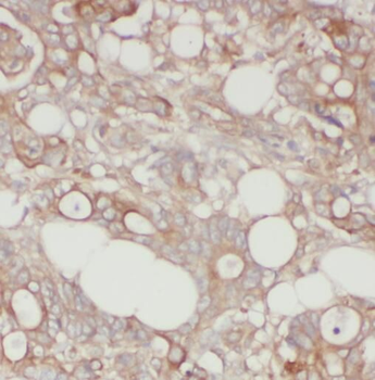 PFN1 Rabbit Polyclonal Antibody