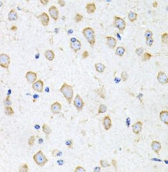 PROK2 Rabbit Polyclonal Antibody