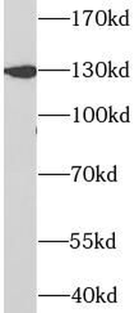 PRPF40A Rabbit Polyclonal Antibody