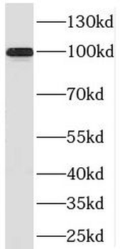 PRPF6 Rabbit Polyclonal Antibody