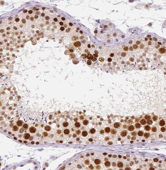 PRPF6 Rabbit Polyclonal Antibody