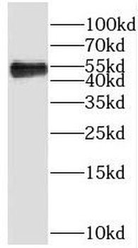 PRR5 Rabbit Polyclonal Antibody