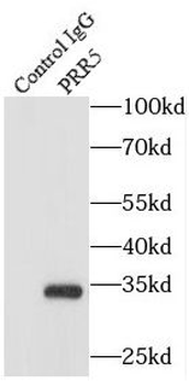 PRR5 Rabbit Polyclonal Antibody