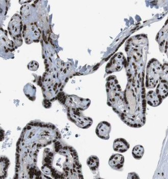 PRR5 Rabbit Polyclonal Antibody