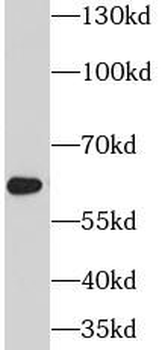 PSAP Rabbit Polyclonal Antibody