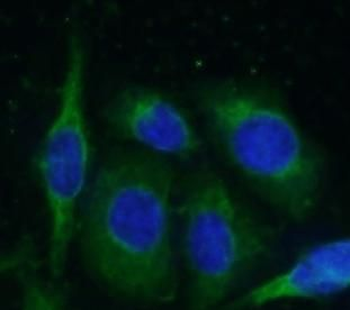 PSAP Rabbit Polyclonal Antibody