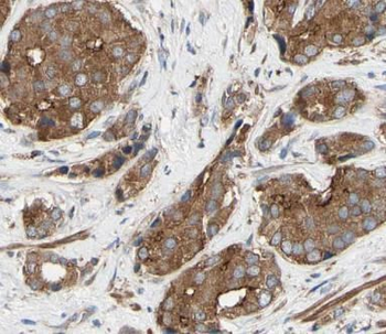 PSAP Rabbit Polyclonal Antibody
