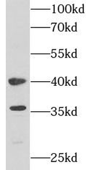 PSAT1 Rabbit Polyclonal Antibody