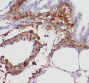 PSAT1 Rabbit Polyclonal Antibody