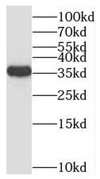 PSCA Rabbit Polyclonal Antibody