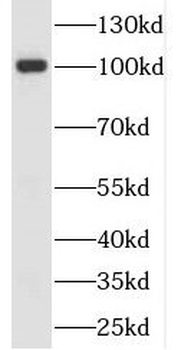 FOLH1 Rabbit Polyclonal Antibody