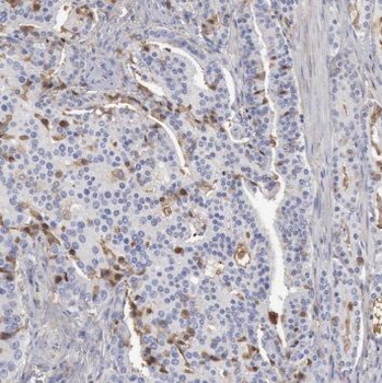 FOLH1 Rabbit Polyclonal Antibody