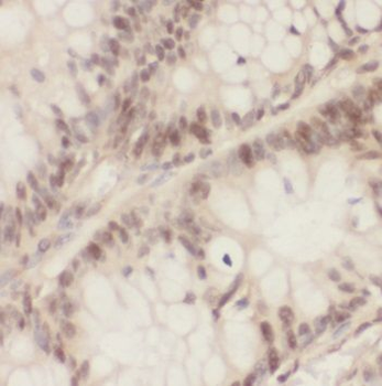 PSMA1 Rabbit Polyclonal Antibody