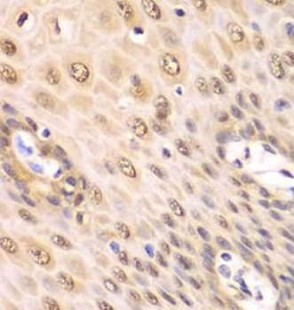 PSMA2 Rabbit Polyclonal Antibody