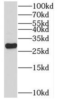 PSMA7 Rabbit Polyclonal Antibody