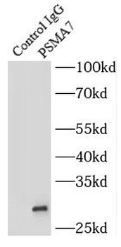 PSMA7 Rabbit Polyclonal Antibody