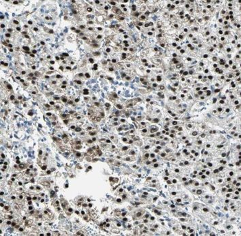 PSMA7 Rabbit Polyclonal Antibody