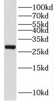 PSMA8 Rabbit Polyclonal Antibody