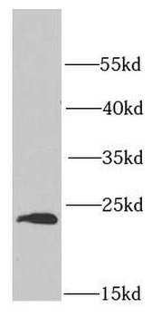 PSMB1 Rabbit Polyclonal Antibody