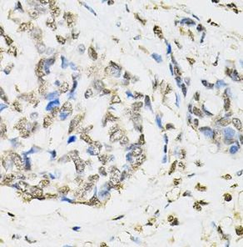 PSMB1 Rabbit Polyclonal Antibody