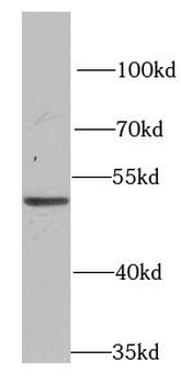 PSMD12 Rabbit Polyclonal Antibody
