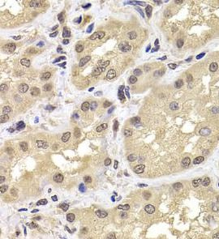 PSMD12 Rabbit Polyclonal Antibody
