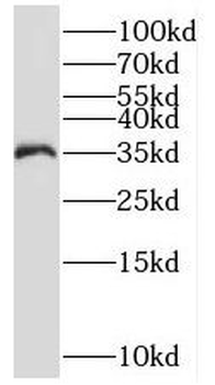 PSMD14 Rabbit Polyclonal Antibody