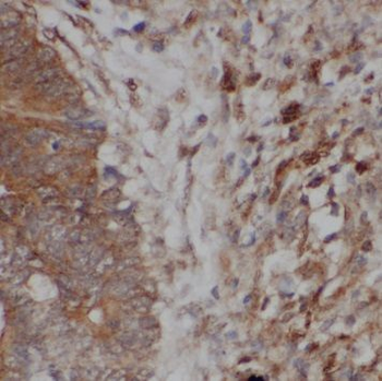PSMD14 Rabbit Polyclonal Antibody