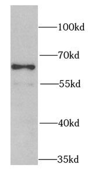 PSMD3 Rabbit Polyclonal Antibody