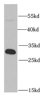 PSME1 Rabbit Polyclonal Antibody