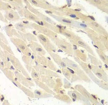 PSME1 Rabbit Polyclonal Antibody