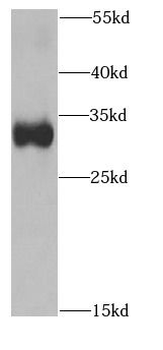 PTGDS Rabbit Polyclonal Antibody