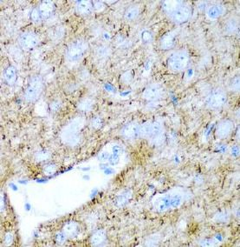 PTGDS Rabbit Polyclonal Antibody
