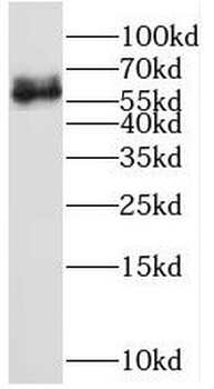 PTH2R Rabbit Polyclonal Antibody