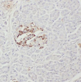 PTH2R Rabbit Polyclonal Antibody