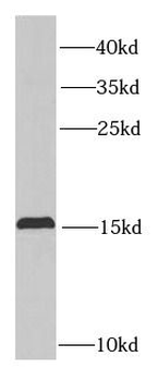 PTP4A3 Rabbit Polyclonal Antibody