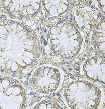 PTP4A3 Rabbit Polyclonal Antibody