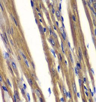 PTPN2 Rabbit Polyclonal Antibody