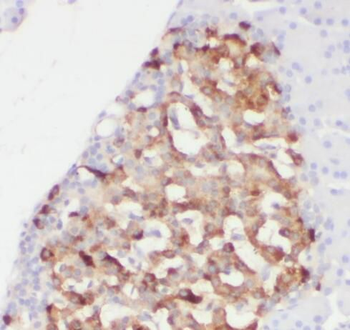 CAVIN1 Rabbit Polyclonal Antibody