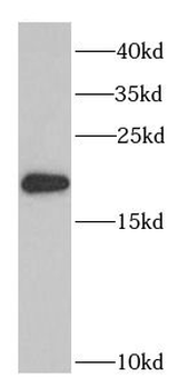 PTRH2 Rabbit Polyclonal Antibody