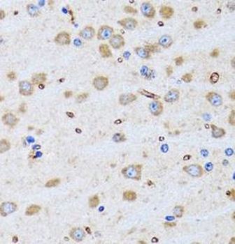 PTRH2 Rabbit Polyclonal Antibody