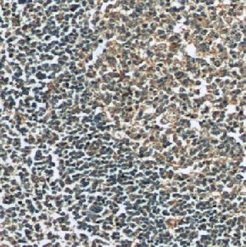 PVRIG Rabbit Polyclonal Antibody