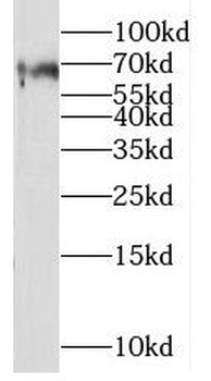 NECTIN3 Rabbit Polyclonal Antibody
