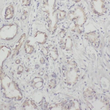 NECTIN3 Rabbit Polyclonal Antibody