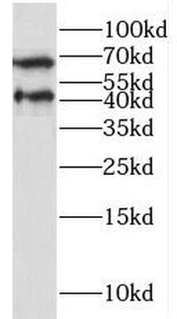 NECTIN4 Rabbit Polyclonal Antibody