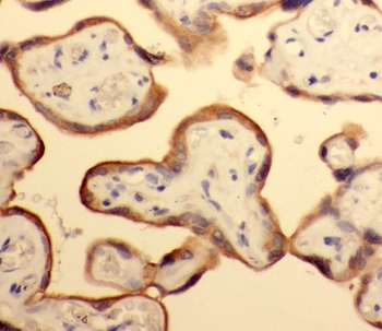 NECTIN4 Rabbit Polyclonal Antibody