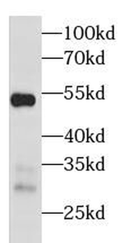NR1I2 Rabbit Polyclonal Antibody