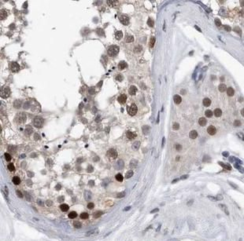 NR1I2 Rabbit Polyclonal Antibody